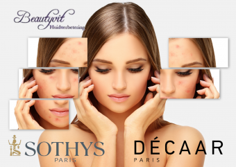beautyvit huidverbetering acne behandeling